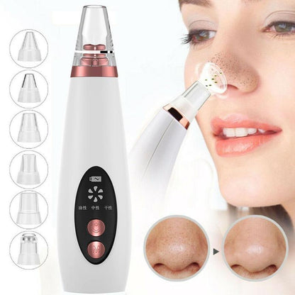 Blackhead Vacuum Cleaner